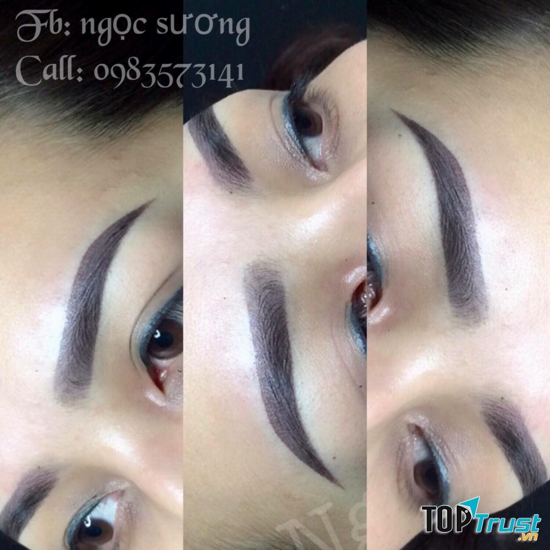 Thẩm mỹ Ngọc Sương