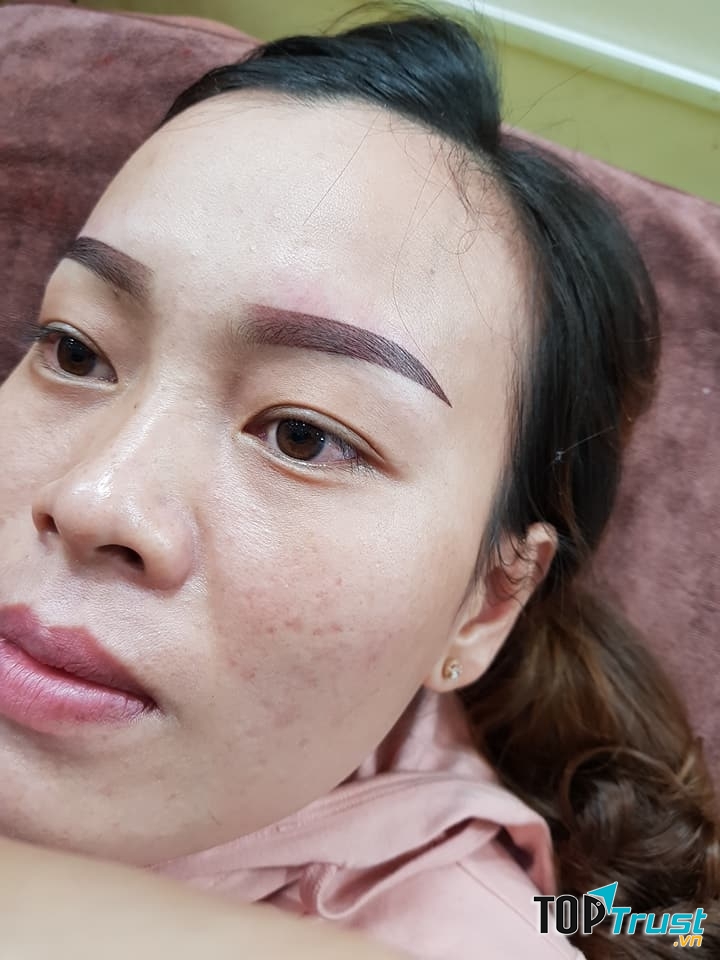 Thẩm Mỹ Nguyên Nhung