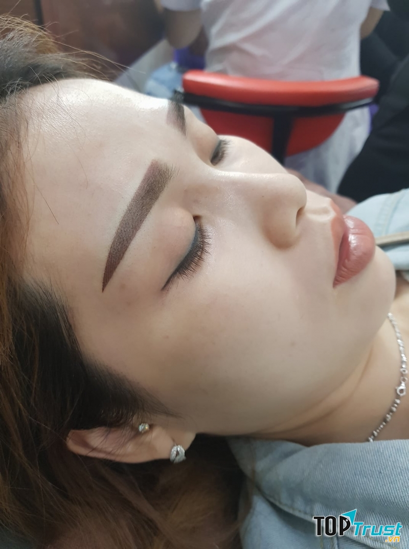 Thẩm Mỹ Nguyên Nhung