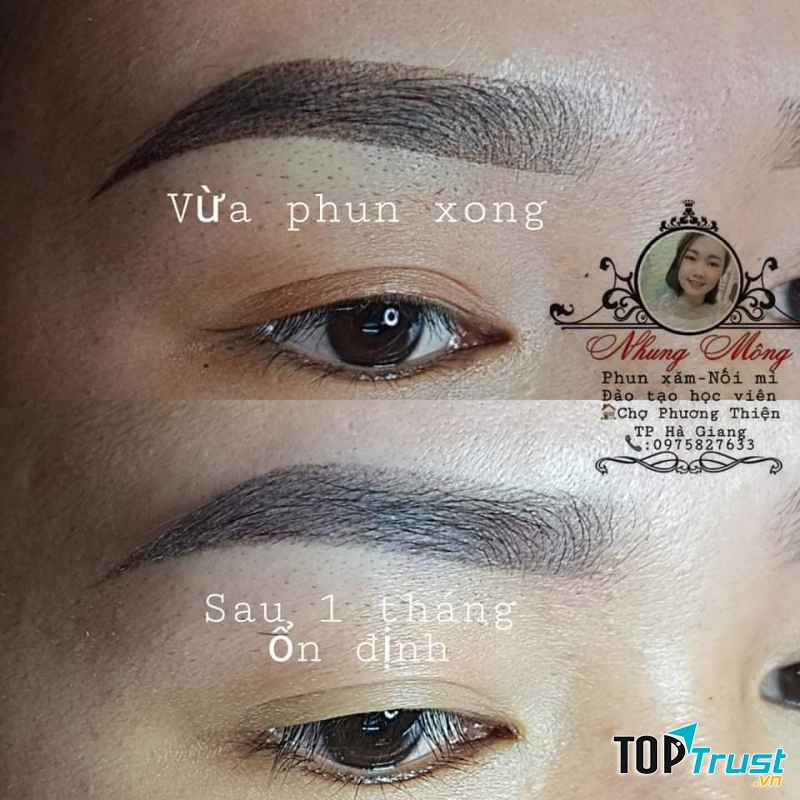 Thẩm Mỹ Nhung Mông