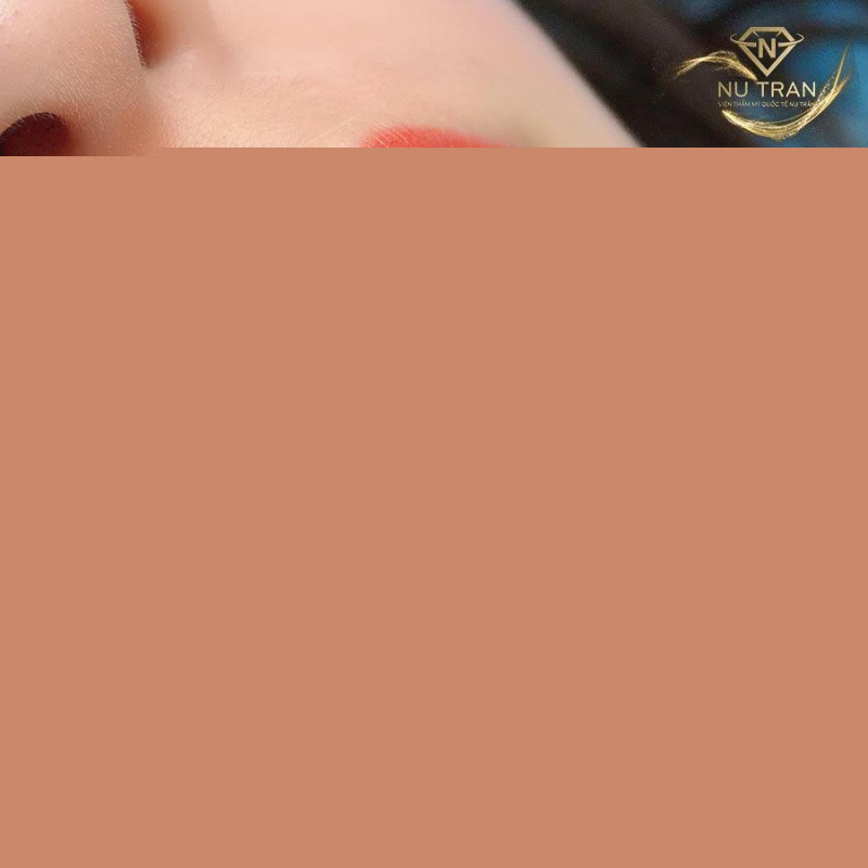 Thẩm Mỹ Nụ Trần