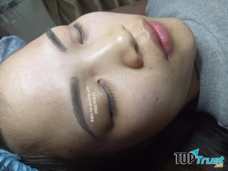 Thẩm mỹ Phương Anh