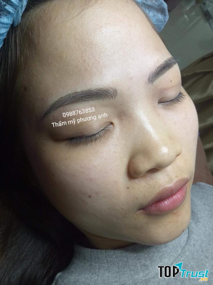 Thẩm mỹ Phương Anh