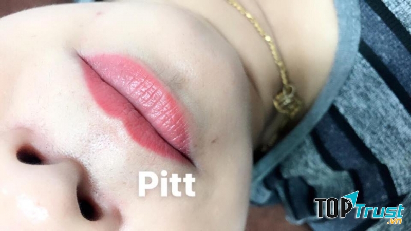 Thẫm mỹ Pitt beauty