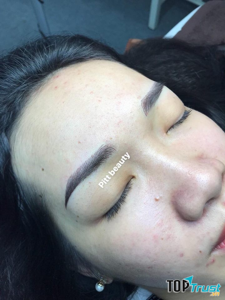Thẫm mỹ Pitt beauty