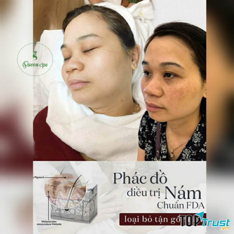 Thẩm Mỹ Queen Spa