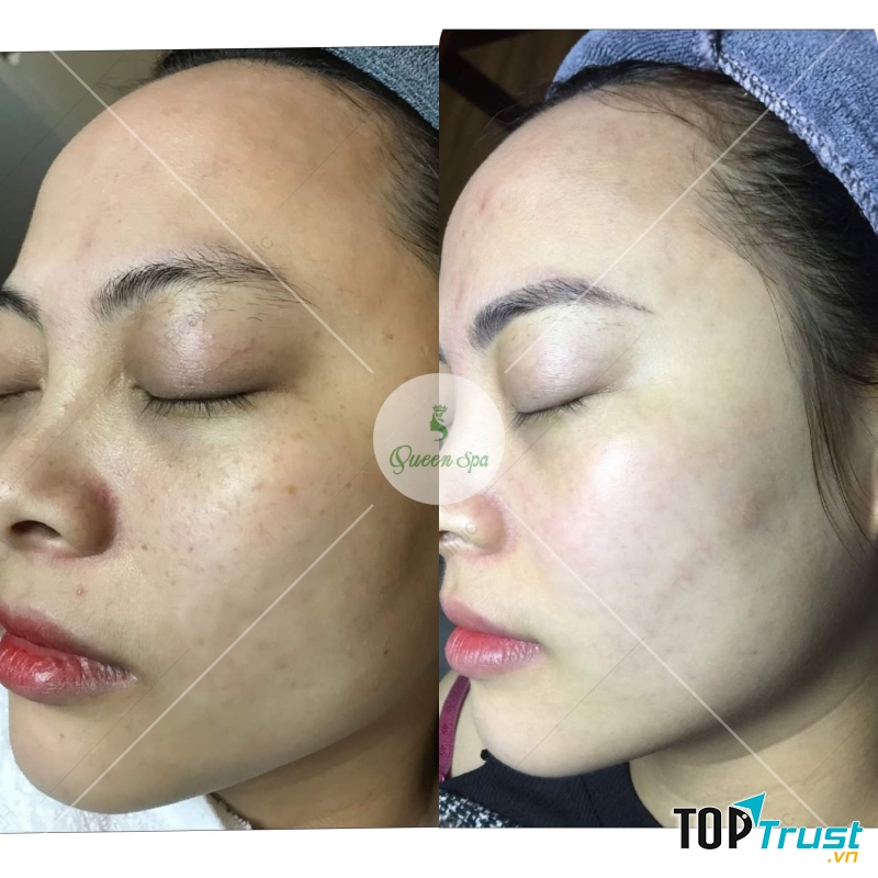 Thẩm Mỹ Queen Spa - Chi nhánh Long An