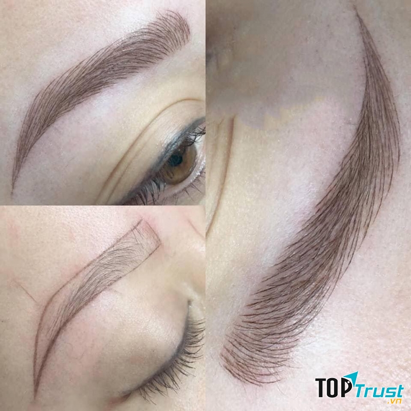 Thẩm mỹ quốc tế Âu Mỹ