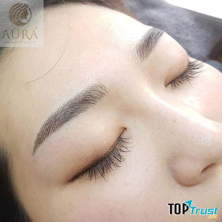 Thẩm Mỹ Quốc Tế Aura - Cần Thơ