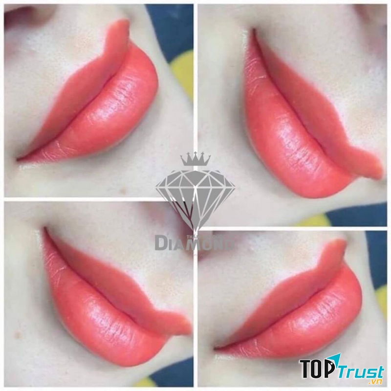 Thẩm Mỹ Quốc Tế Diamond Vũng Tàu