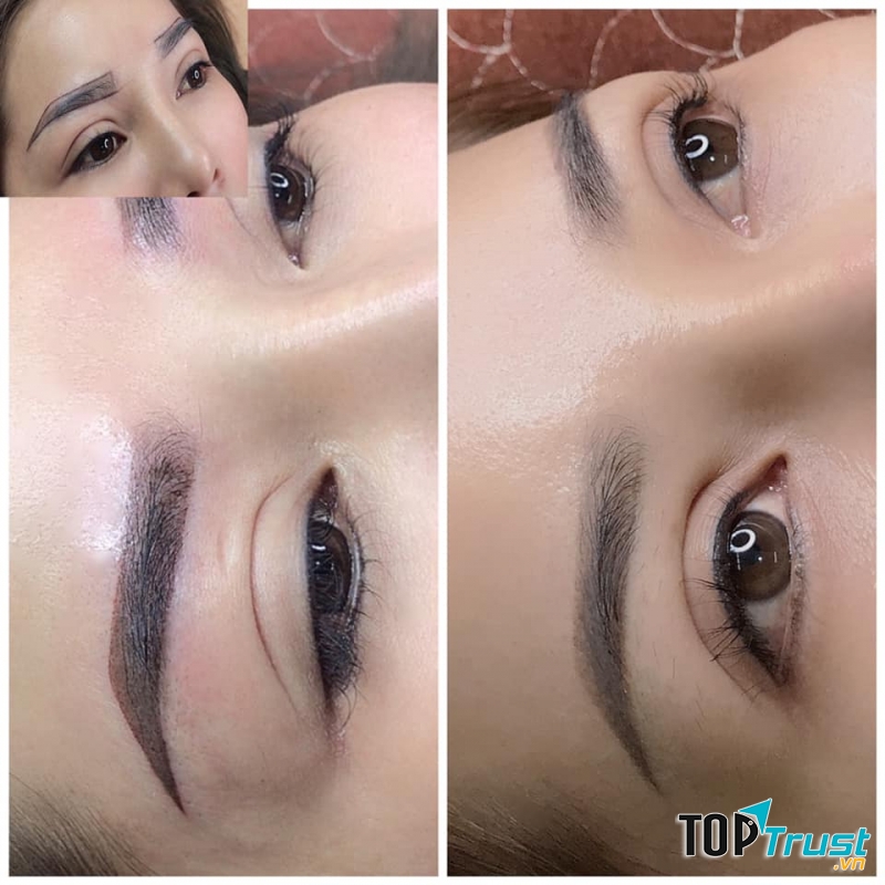 Thẩm Mỹ Quốc Tế Hoàn Mỹ