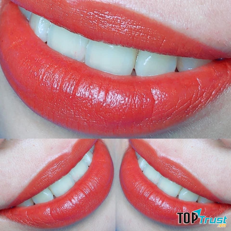 Thẩm Mỹ Quốc Tế Hoàn Mỹ