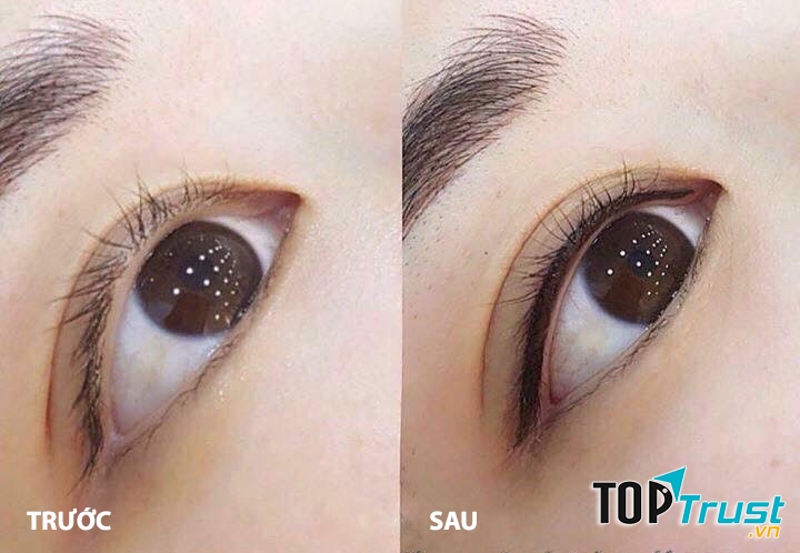 Thẩm Mỹ Quốc Tế Hoàn Mỹ