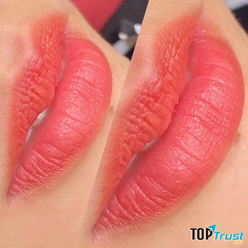 Thẩm Mỹ Quốc Tế Hoàn Mỹ