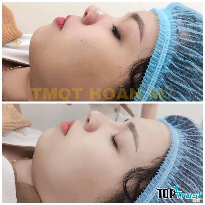 Thẩm Mỹ Quốc Tế Hoàn Mỹ