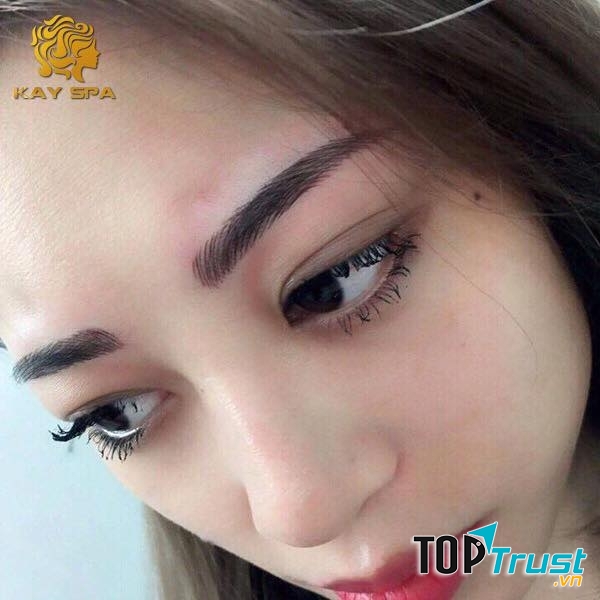 Thẩm Mỹ Quốc Tế Kay Spa - địa chỉ nhấn mí mắt đẹp và an toàn nhất ở TP. HCM