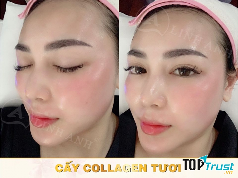 Thẩm mỹ Quốc tế Linh Anh