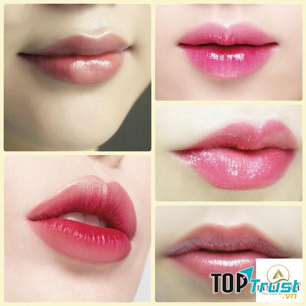 Thẩm mỹ Quốc tế Linh Anh