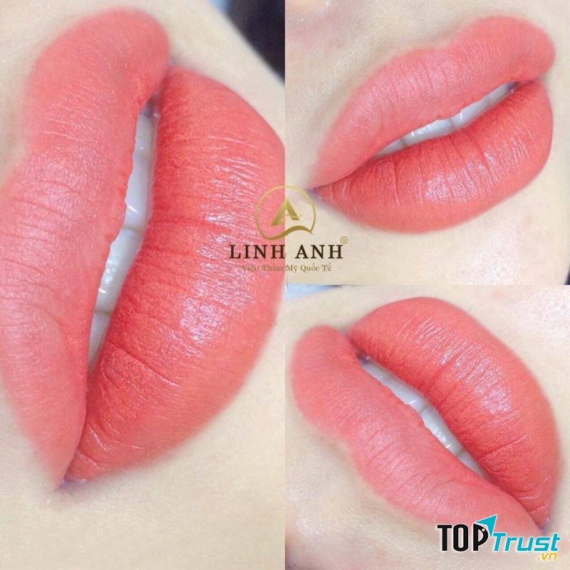 Thẩm mỹ Quốc tế Linh Anh