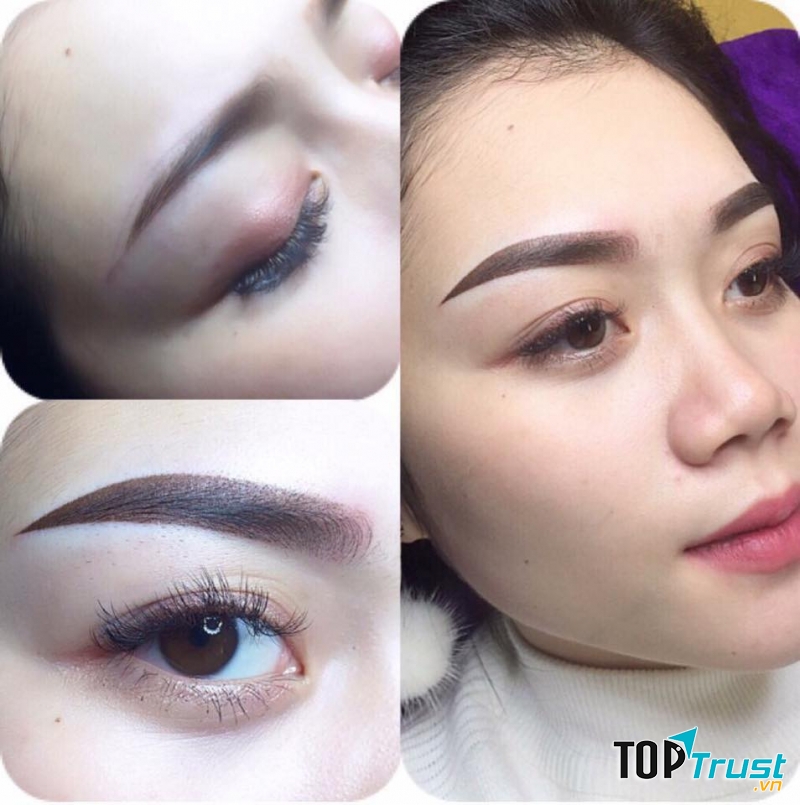 Thẩm mỹ Quốc tế Linh Anh