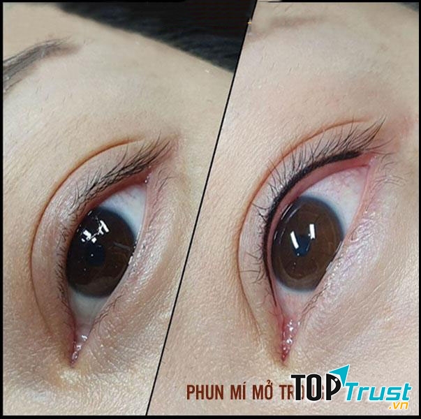 Thẩm Mỹ Quốc Tế Linh Anh