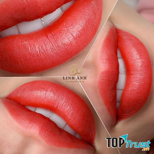 Thẩm mỹ Quốc tế Linh Anh