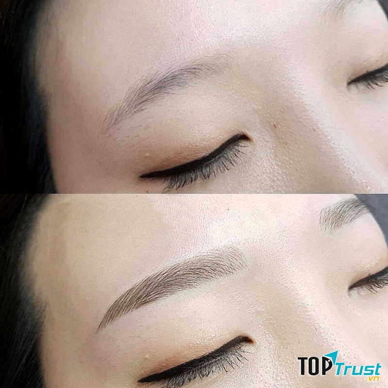 Thẩm Mỹ Quốc Tế Linh Anh - Biên Hòa