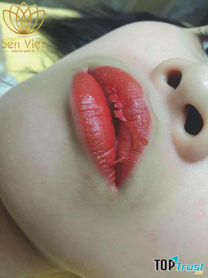 Thẩm Mỹ Quốc Tế Sen Việt - Hạ Long