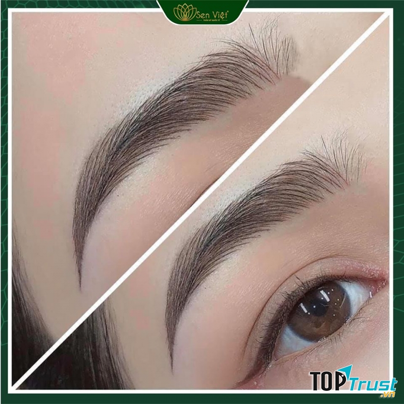 Thẩm Mỹ Quốc Tế Sen Việt - Hạ Long