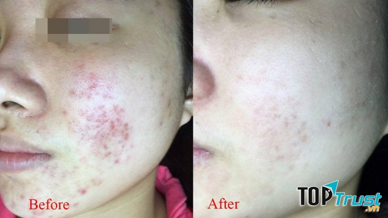 Thẩm mỹ Rio Beauty & Spa