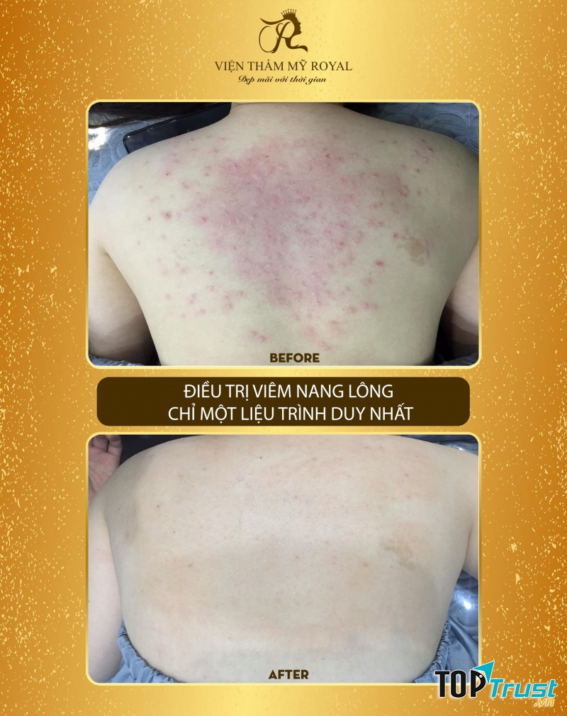 Thẩm Mỹ Royal - Thái Nguyên