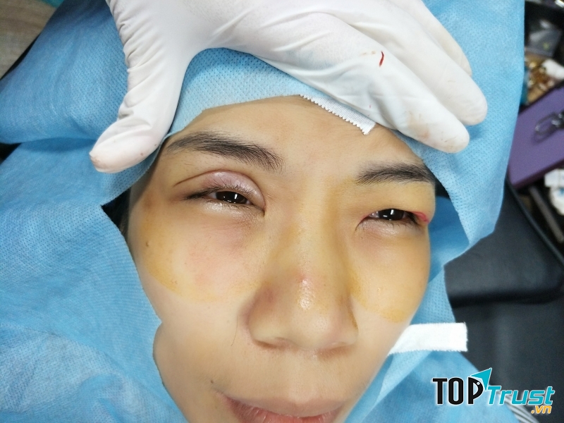Thẩm Mỹ Sầm NaNa