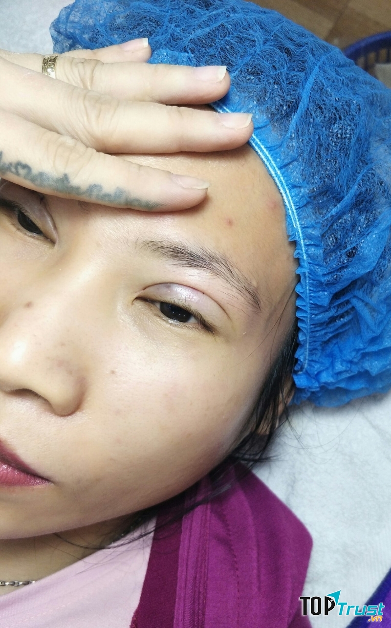 Thẩm Mỹ Sầm NaNa