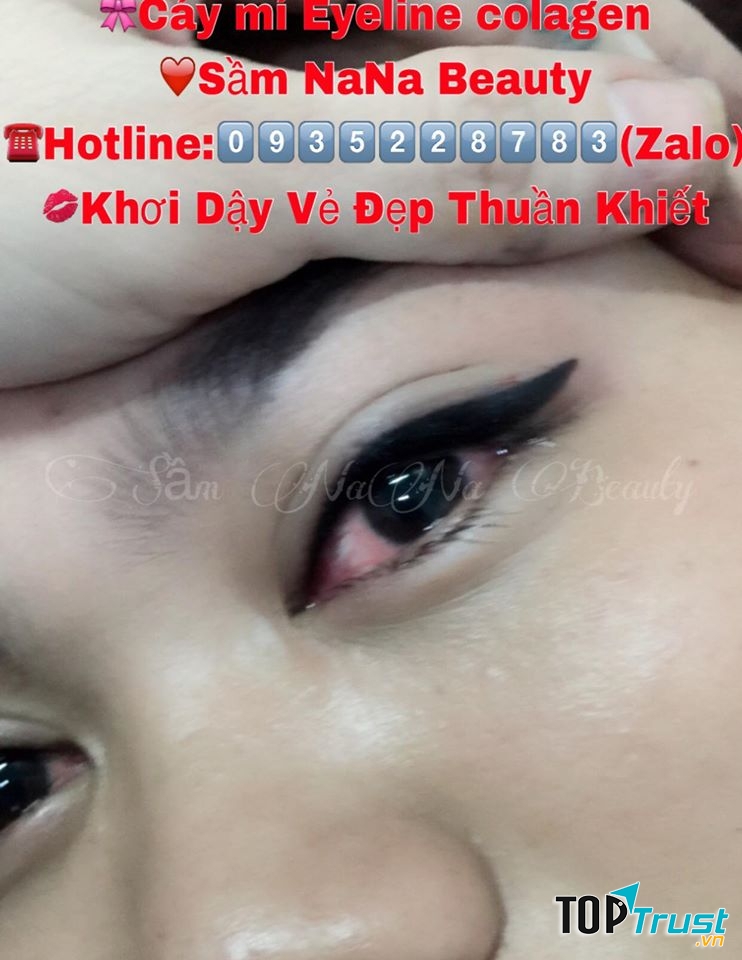 Thẩm Mỹ Sầm NaNa