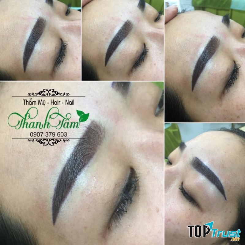 Thẩm mỹ Thanh Tâm