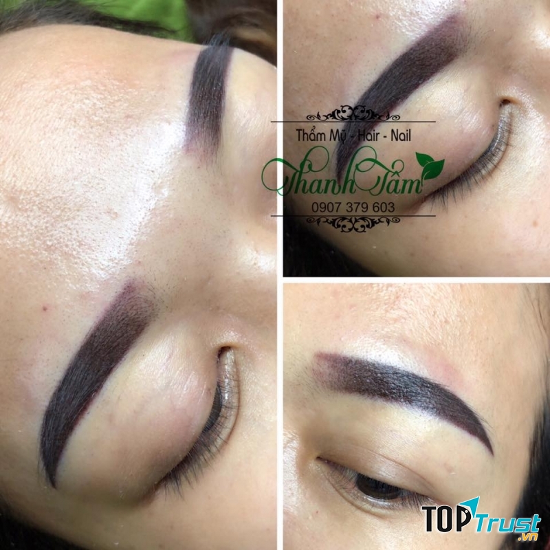 Thẩm mỹ Thanh Tâm