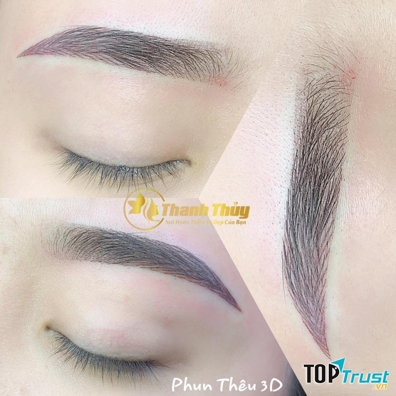 Thẩm mỹ Thanh Thủy