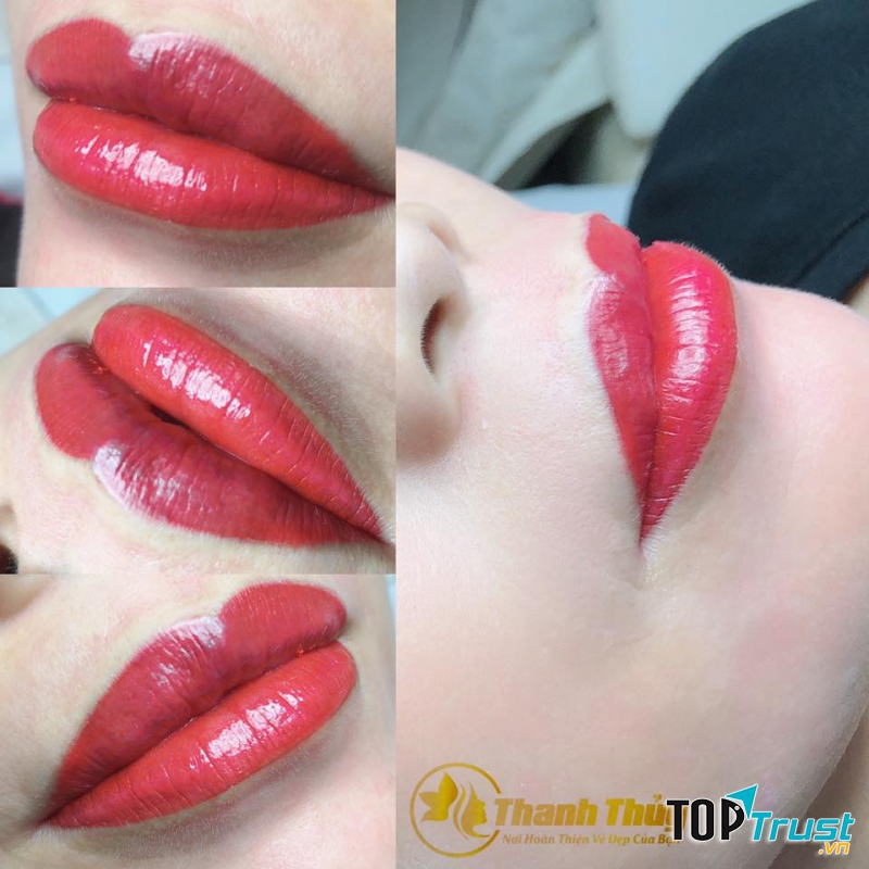 Thẩm mỹ Thanh Thủy