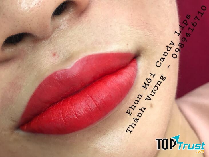 Thẩm Mỹ THÀNH VƯƠNG