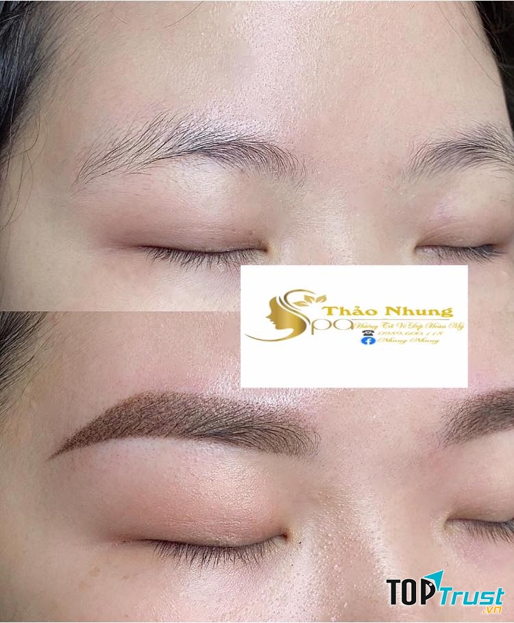Thẩm mỹ Thảo Nhung