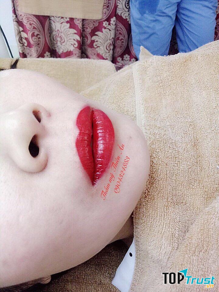 Thẩm mỹ Thiên Ân