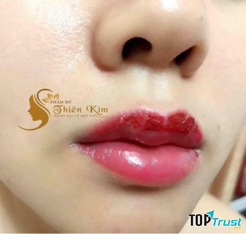 Thẩm Mỹ Thiên Kim