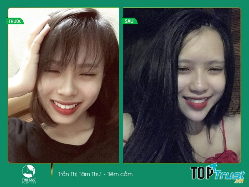 Thẩm mỹ Thu Cúc Sài Gòn