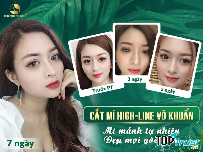 Thẩm mỹ Thu Cúc Sài Gòn