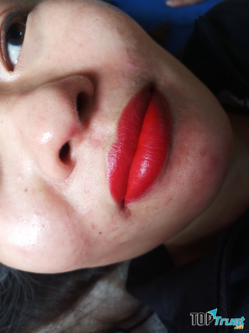 Thẩm Mỹ Thu Hương