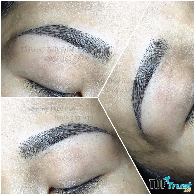 Thẩm Mỹ Thủy Ruby