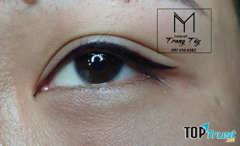 Thẩm Mỹ Trang Tây