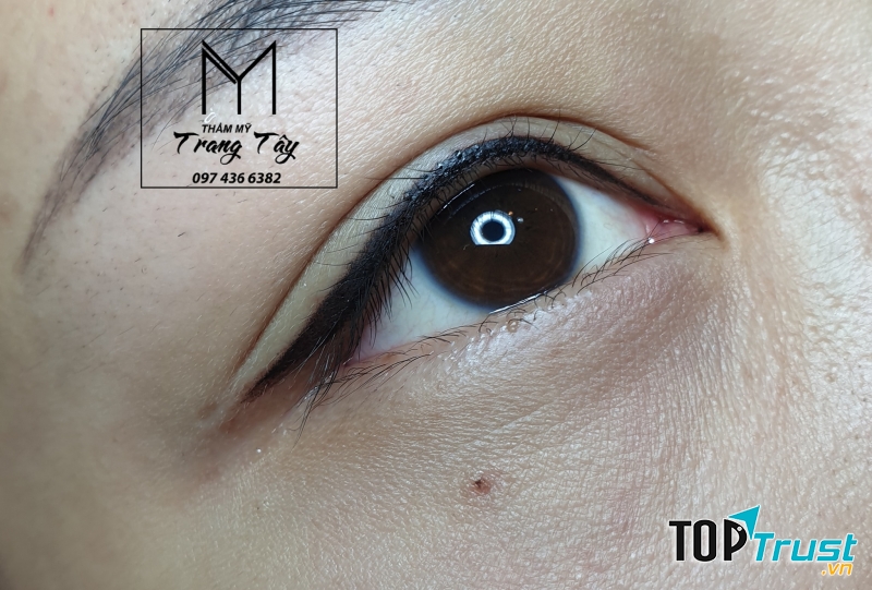 Thẩm Mỹ Trang Tây