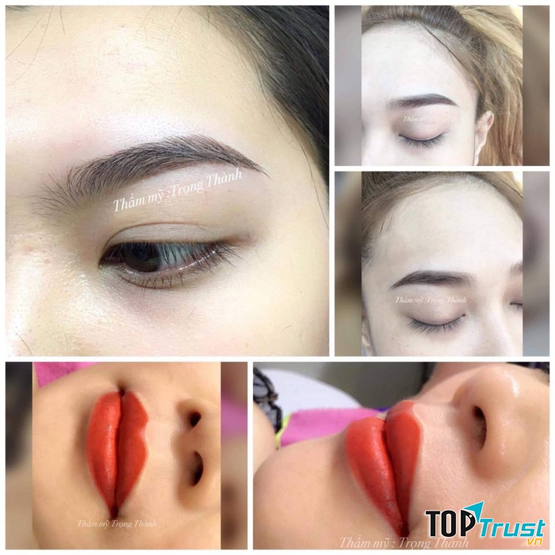 Thẩm mỹ Trọng Thành