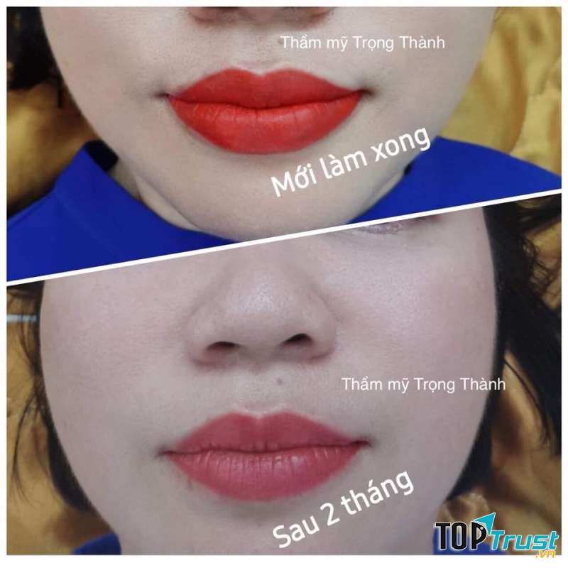 Thẩm mỹ Trọng Thành